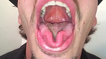 Mouth Rhett Part10ビデオ2プレビュー