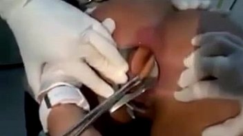 Ärzte entfernen Dildo im Arsch der Frau gefangen