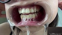 Eine Frau zeigt ihr Zahnfleisch und spuckt Speichel aus