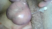 in testicles
