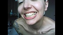I denti di Chantal si sfaldano, marci e neri