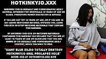 Il gigantesco dildo blu distrugge totalmente il buco del prolasso anale di Hotkinkyjo