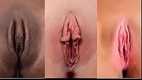 Tipi e forme di vajinas