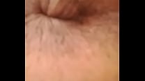 hair removal 2